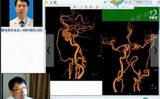 三博醫(yī)院劉方軍：顱內(nèi)外血管搭橋治療復(fù)雜頸內(nèi)動(dòng)脈動(dòng)脈瘤