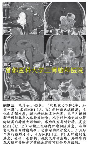 病例三