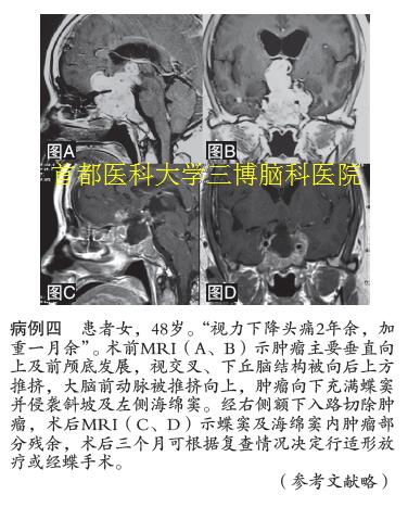 病例四