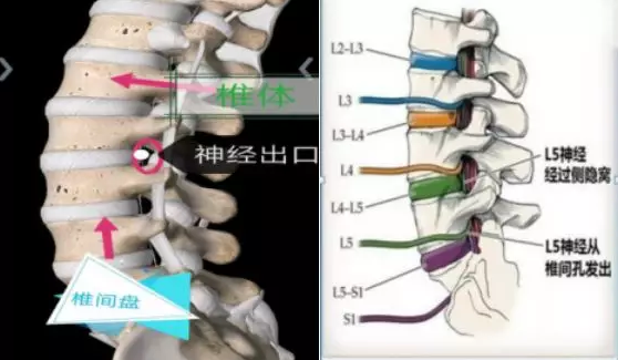 腰椎間盤(pán)突出，總有一種治療方式適合你！