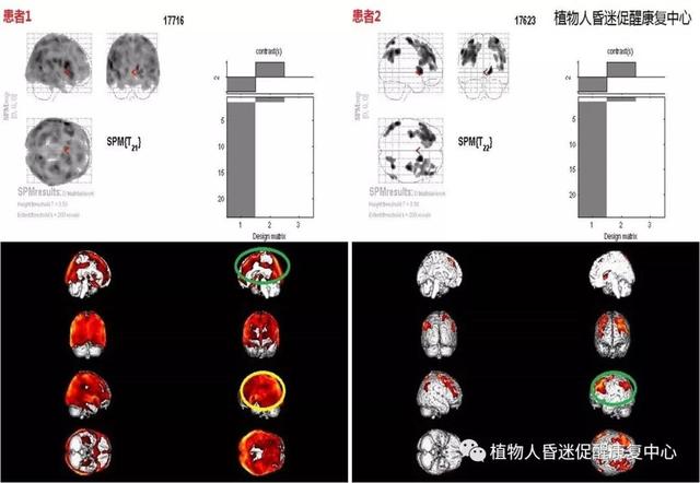 功能影像評估。