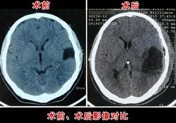 小村里走出碩士研究生 陽光大男孩與病魔頑強抗爭