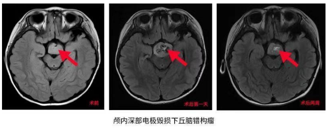 3歲女童愛笑性格好？她的“微笑”卻讓父母操碎了心