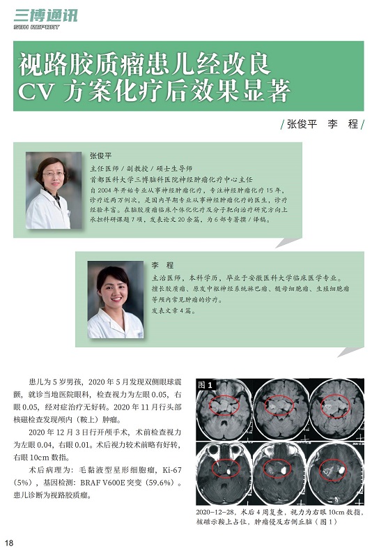 視路膠質(zhì)瘤患兒經(jīng)改良 CV 方案化療后效果顯著