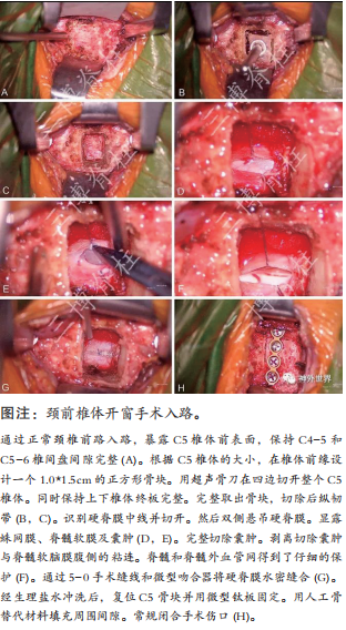 專訪范濤教授 - 唇亡齒寒： 脊髓脊柱外科的前世、今生與未來